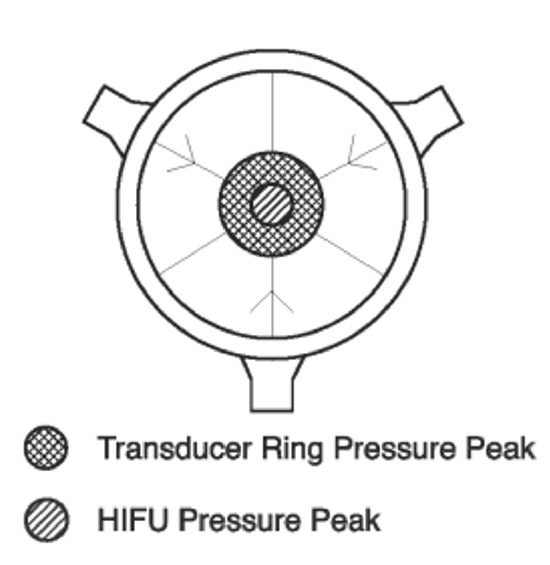 /getattachment/2e348df4-5ee6-475d-8dd2-eccb0d40c7b4/sonoreactor-top.png?lang=en-GB A top view of the sonoreactor design