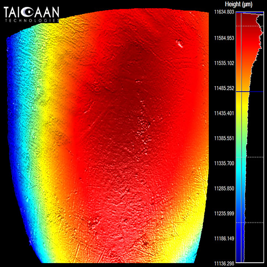 combining-complex-data-sets-to-understand-dental-wear-npl