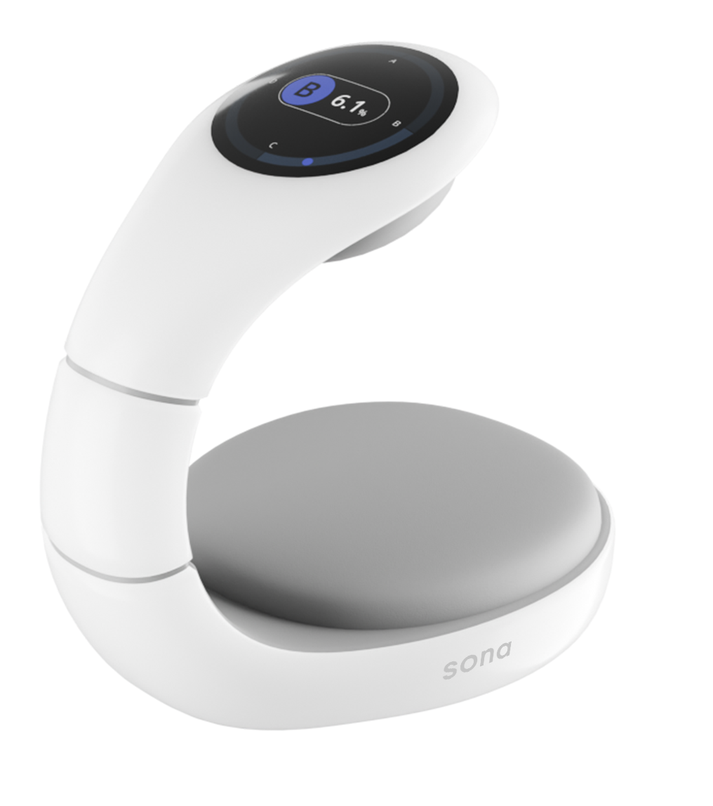 White and grey Sona breast scanner with a curved design and digital display screen showing breast scan data.